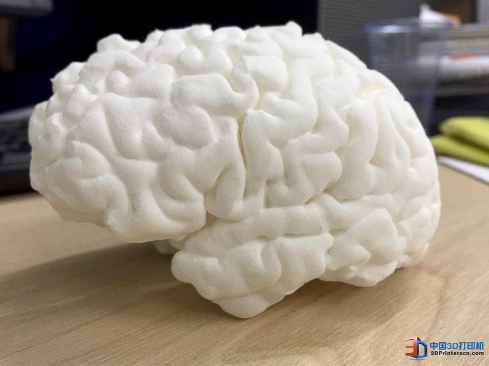 未來(lái)醫(yī)療行業(yè) 3D打印技術(shù)融入其中的四種方式

3D醫(yī)療行業(yè),3D打印心臟,3D打印大腦,3D打印應(yīng)用,3D打印領(lǐng)域,3D打印和醫(yī)療的關(guān)系,3D打印平臺(tái),3D打印服務(wù),3d打印企業(yè)服務(wù)平臺(tái)