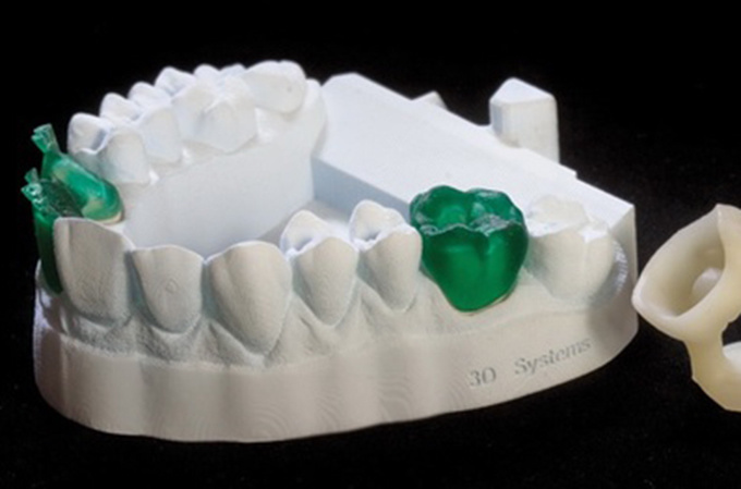 德國率先引入3D打印牙齒技術(shù) 全程體驗(yàn)“無痛”種牙-e鍵打印|3D打印服務(wù)
3d打印牙齒,3D打印種牙,無痛種牙,3D打印平臺,3D打印服務(wù),南京哪里有3D打印,南京3D打印廠家,南京3D打印服務(wù)