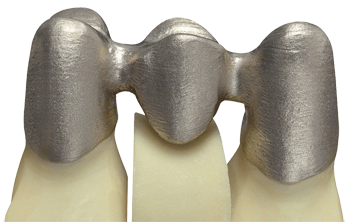 德國率先引入3D打印牙齒技術(shù) 全程體驗(yàn)“無痛”種牙-e鍵打印|3D打印服務(wù)
3d打印牙齒,3D打印種牙,無痛種牙,3D打印平臺,3D打印服務(wù),南京哪里有3D打印,南京3D打印廠家,南京3D打印服務(wù)