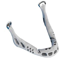 3d打印下頜骨成功移植 置換人體器官不再是夢-e鍵打印|3D打印服務
醫療3d打印技術,3D打印下頜骨,3D打印人體器官,3D打印器官,3D打印心臟,3D打印假肢,3D打印大腦,3D打印技術,3D打印服務,3D打印云平臺