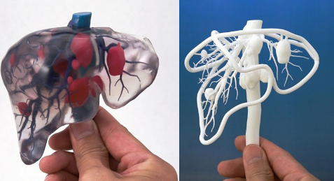 個性化醫療3D打印實戰案例與研究成果的問答整理_3d打印服務公司