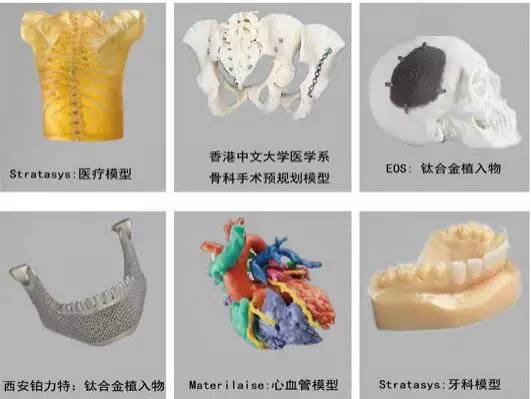 3d打印在醫(yī)療領(lǐng)域的應用 3D打印與醫(yī)療行業(yè)白皮書