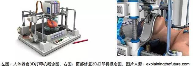 3d打印在醫(yī)療領(lǐng)域的應用 3D打印與醫(yī)療行業(yè)白皮書