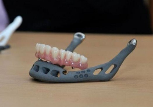 醫療3D打印的假牙 新手選擇3D打印手板模型加工打樣還是CNC加工?選擇當地還是全國3D打印公司?